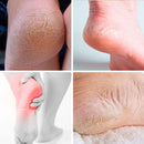 Palmilha de Silicone Anti Rachadura - Foot Care - Kabana Prime